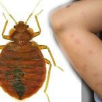 Bed Bug Exterminators Southern California