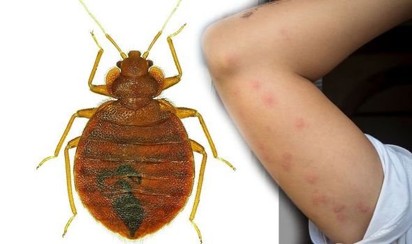 6 Things To Know About Bed Bugs